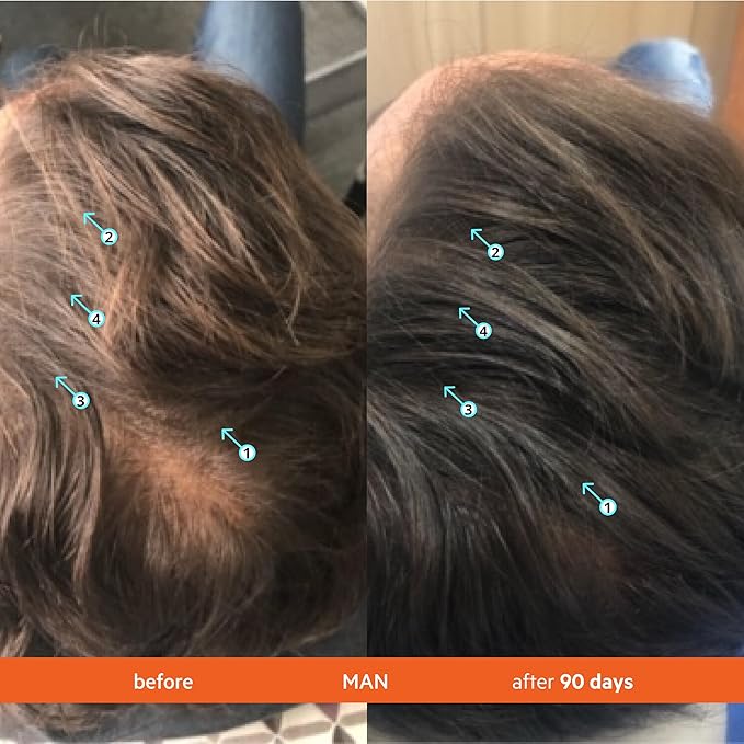 DS Labs Revita Shampoo and Conditioner – High-Performance Hair Density Kit, Volumizing, Thickening, Fuller, Sulfate & Silicone Free, For Men & Women, 925mL, Packaging May Vary-VivaGrace Women