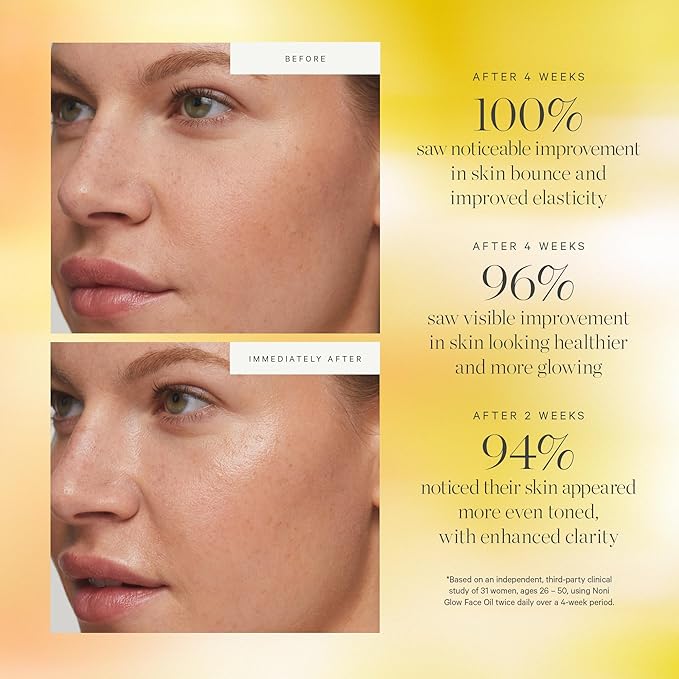 KORA Organics Noni Glow Hydrating Face Oil for Women with Rosehip, Gua Sha Oil, Certified Organic, Cruelty Free, 1.69 fl oz-VivaGrace Women