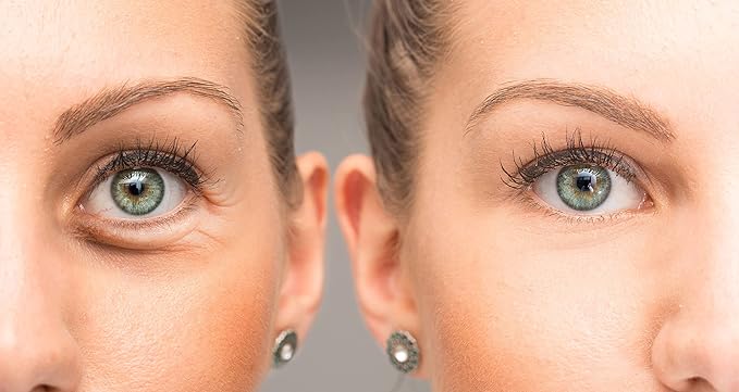 Anti Aging Eye Cream, Bright Eyes, Daily Wrinkle Cream for Firming, Dark Circles, Puffiness-VivaGrace Women