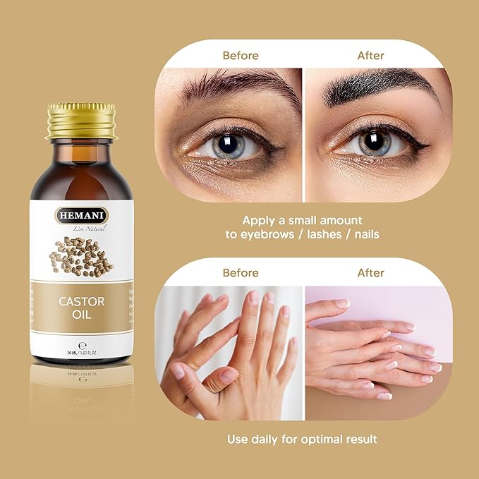 Hemani Castor Oil Ricinus communis - 30mL | Natural Skin & Hair Care, Pure Cold-Pressed Oil for Radiant Glow, Anti-Aging, Hydration & Wellness.-VivaGrace Women