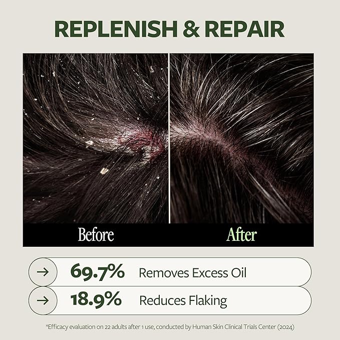 LAPCOS DR.14 REVITALIZING SCALP CARE SHAMPOO-VivaGrace Women