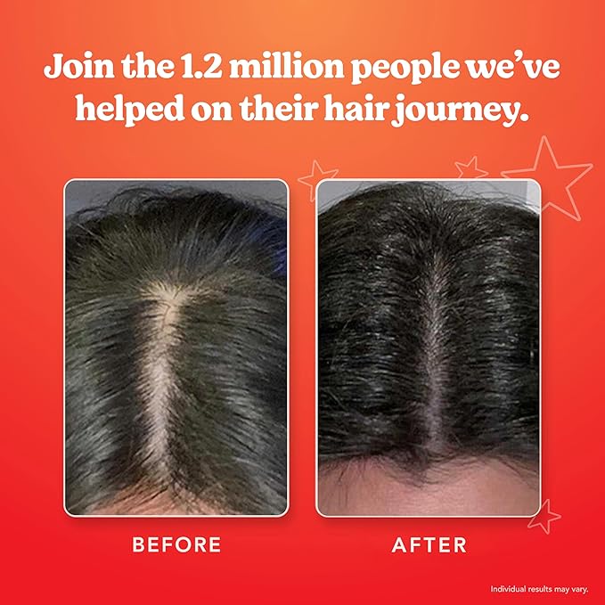HAIRtamin Scalp Serum Natural Hair Growth Thickening | Made in USA | Helps Increase Hair Thickness and Aids Against Hair Thinning and Hair Fall Out | Moisturizes and Soothes Dry Itchy Scalp-VivaGrace Women