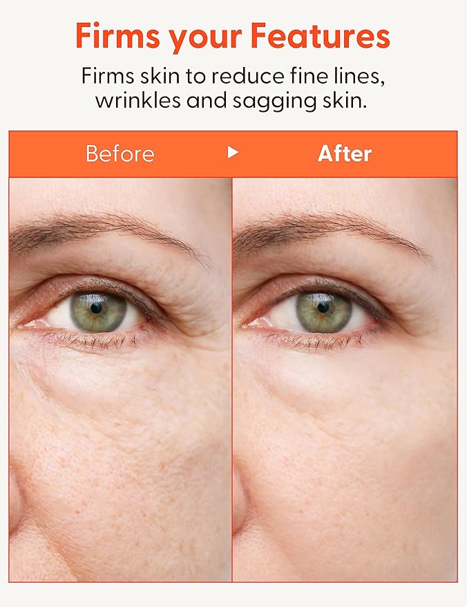 It'S SKIN Collagen Nutrition Emulsion - Marine Collagen Volume & Firming Facial Lotion, Intense Revitalizing & Elasticity for Rough and Aging Skin, 5.07 fl.oz.-VivaGrace Women