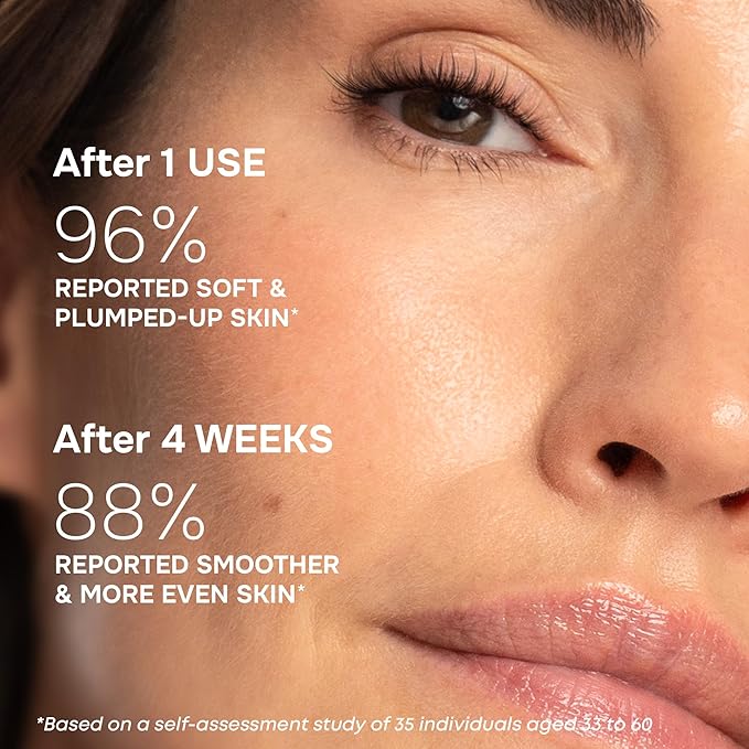 SimplyVital Moisturizer for Neck & Décolleté – With Collagen, Retinol, Peptides & Hyaluronic Acid – Anti-Aging Hydration – Made in USA – 1 fl.oz-VivaGrace Women