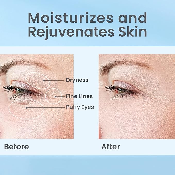 Hydrate& Replenish EYE CREAM- Gel Hydrator-Cream with Hyaluronic Acid & Marine Extracts, attracts moisture to the skin Algae And Seaweed Extracts to revitalize dull looking skin 0.5 Oz-VivaGrace Women