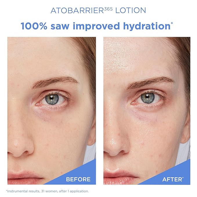 AESTURA ATOBARRIER365 Lightweight Cream + Facial Mist-VivaGrace Women
