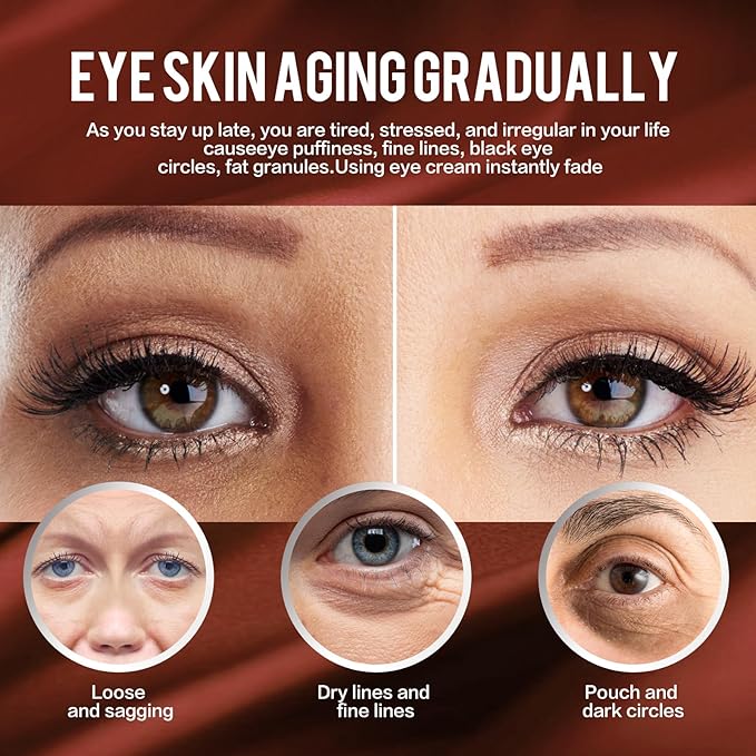 Retinol Eye Cream,Anti Aging Eye Cream, Retinol Eye Stick for Dark Circles and Puffiness Bags Treatment, Eye Balm Instantly Brighten,Under Eye Cream,Eye Cream for Wrinkles,Reduces Fine Lines-VivaGrace Women