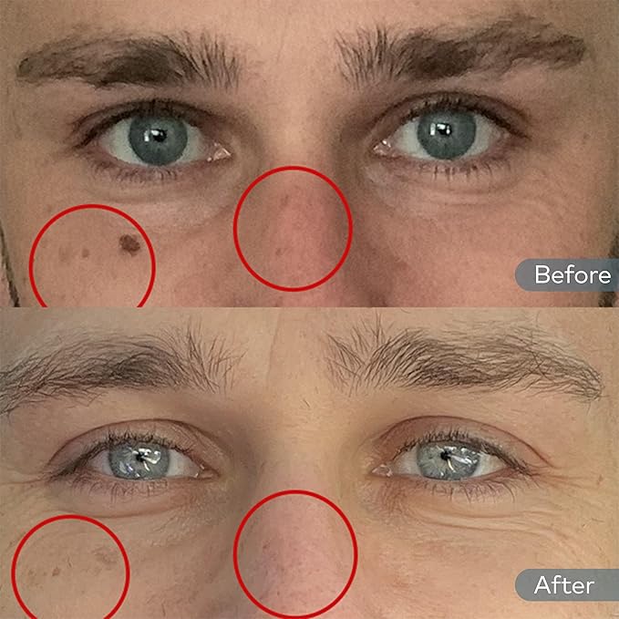 Onekind Dream Cream Night Moisturizer – Hydrating Anti-Aging Face Cream with Squalane, Rosehip & Shea Butter – Fragrance-Free, Vegan, for Dry & Sensitive Skin – 1.7 oz-VivaGrace Women