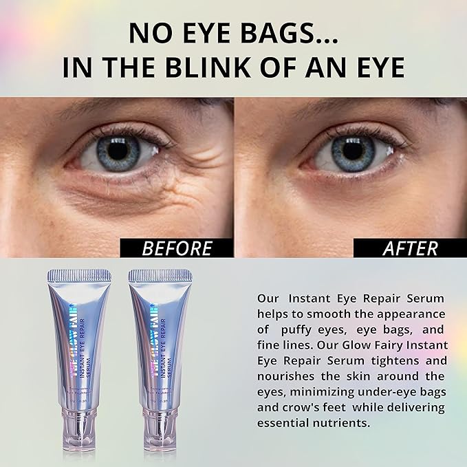 Eye Repair Serum (10g) - Under Eye Cream for Dark Circles to Reduces Eye Bags, Puffiness and Wrinkles - Eye Cream (2 pack)-VivaGrace Women