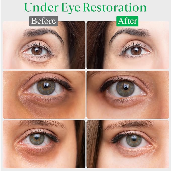 EyeGLO Caffeine Eye Cream for Dark Circles, Eye Bags, and Puffiness | Under Eye Treatment for Women with Peptides, Antioxidants, Hyaluronic Acid | Natural Brightening Eye Cream - 1 Oz-VivaGrace Women