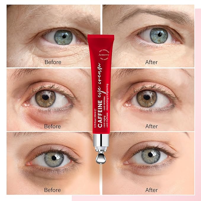 Caffeine Eye Cream Anti Aging: Eye Cream With Retinol, Sodium Hyaluronate, Vitamin E, For Dark Circles, Wrinkles, Puffiness & Fine Lines - Advanced Metal Applicator For Under Eye Bags And Puffy Eyes-VivaGrace Women