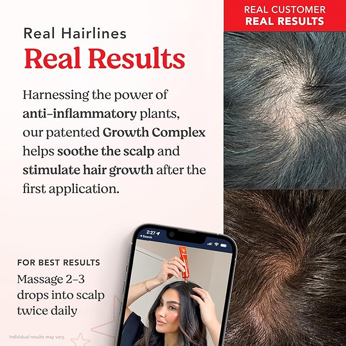 HAIRtamin Scalp Serum | Visibly Thicker, Nourished Hair and Healthy Scalp Treatment (Two Pack)-VivaGrace Women