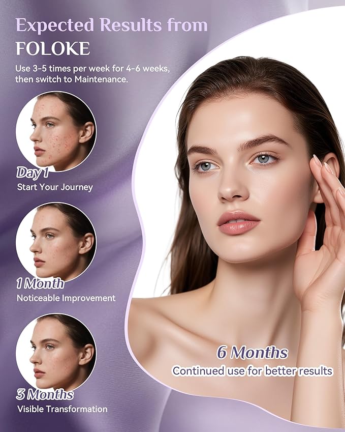 FOLOKE Red Light Therapy Mask for Face & Neck, LED Face Light Therapy,USB C Rechargeable,Infrared Mask for Home Working Travel Yoga-VivaGrace Women