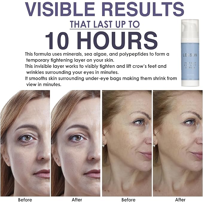 Instant Eye Lift Serum - Provides Immediate Visible Results, Lifts Away Appearance of Lines & Wrinkles. Dark Circles Under Eye Treatment, Eye Cream for Dark Circles and Puffiness-VivaGrace Women