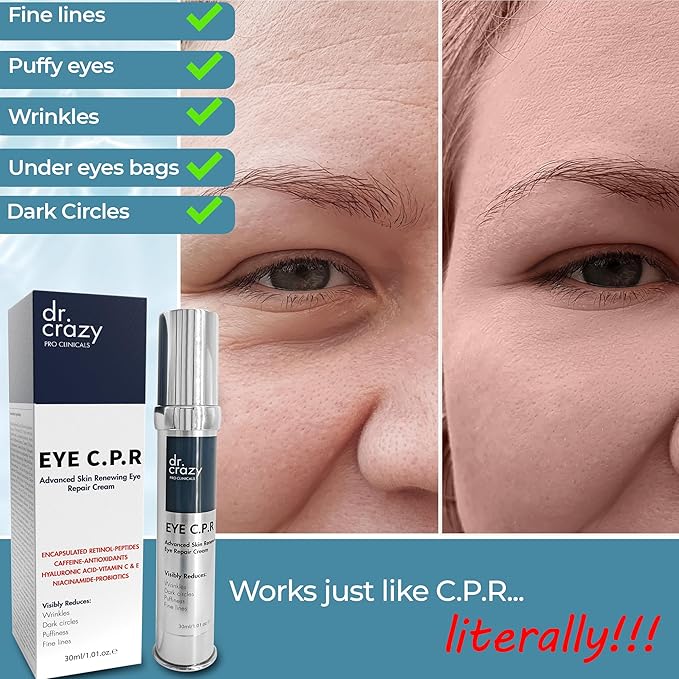 Eye C.P.R | Daily Caffeine & Retinol Under Eye Cream | All in One | Wrinkles & Fine Lines | Firming, Dark Circles, Puffiness | Complex Anti Aging Formula | 30ml-VivaGrace Women