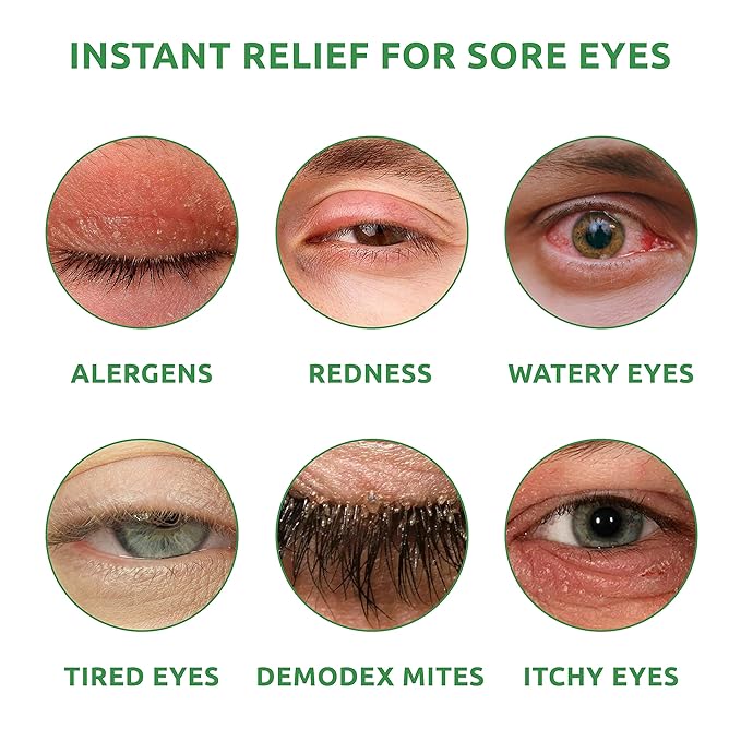 Eyelid Wipes with Tea Tree & Aloe Vera + Steam Eye Mask for Dry Eyes Daily Eyelid Cleanser & Self-Heating Eye Mask for Relaxation & Relief | 30 Eyelid Wipes & 16 Eye Masks