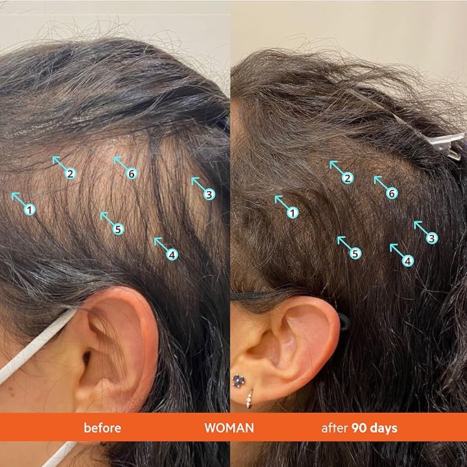 DS Labs Revita Shampoo and Conditioner – High-Performance Hair Density Shampoo & Conditioner, Volumizing & Thickening, Fuller, Healthier-Looking Hair, Sulfate & Silicone Free, For Men & Women, 205mL-VivaGrace Women