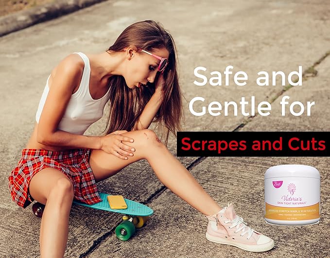 Best Stretch Marks Cream Prevent & Reduce Marks Reduce Pregnancy Stretch Marks Highly Concentrated Cream includes $29 Scar Reducing Guide-VivaGrace Women