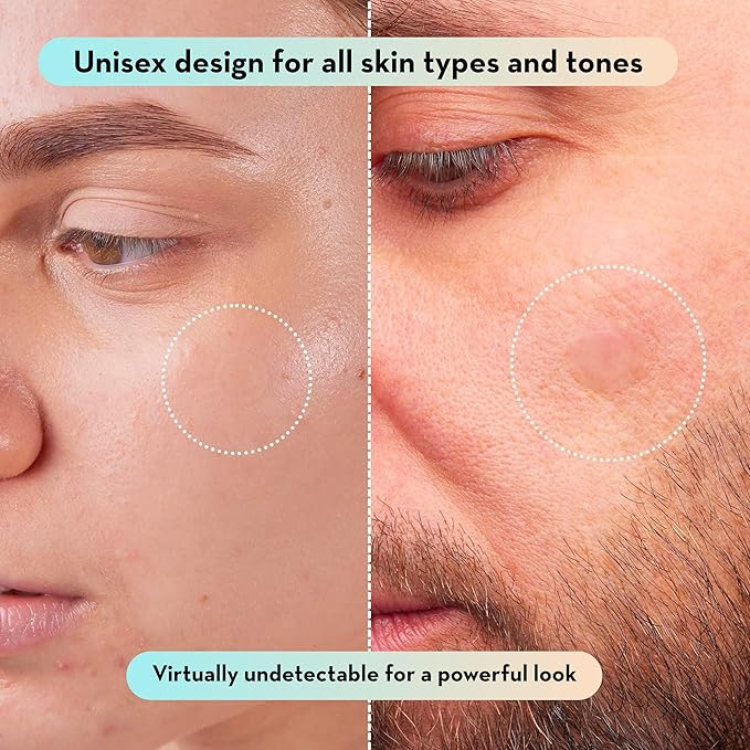 LE GUSHE Korean Pimple Patches for Face (132 Dots) - Hydrocolloid Acne Patches with Tea Tree Oil - Invisible Zit Stickers - Dermatologist Tested - Korean Skin Care