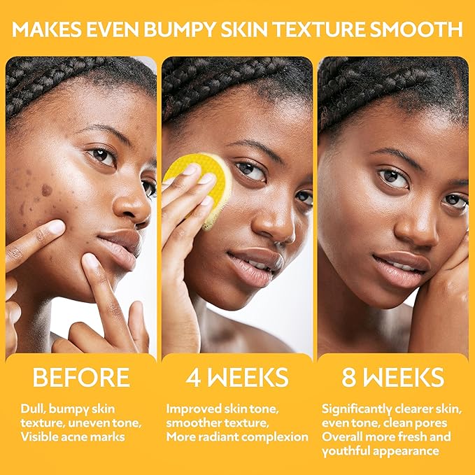Turmeric Kojic Acid Cleansing Pads - Brightening Dark Spot Remover, Deep Cleaning Pores & Exfoliating Vitamin C & Aloe Vera - Foaming Turmeric Face Scrub Pads For Skin Lightening - 60 Count