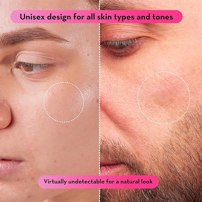 LE GUSHE Pimple Patches for Face (66 Dots) - Hydrocolloid Acne Patches for Face - Invisible Zit Stickers - Flatten Spots in 6-8 Hrs