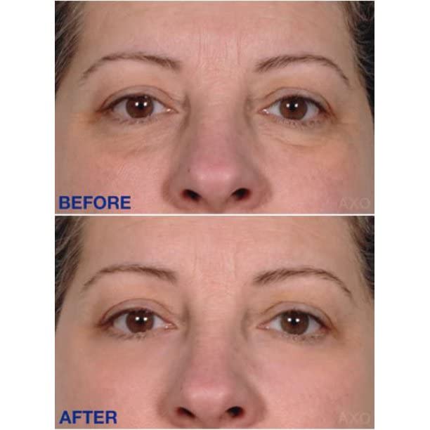 Age-Defying Under-Eye Serum | Best Instant Wrinkle Remover | Advanced Formula Anti Aging Visibly Reduces Under Eye Wrinkles, Bags, Dark Circles, Fine Lines & Crow’s Feet | 100% All-Natural-VivaGrace Women