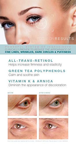 Under Eye Repair Cream - All-Trans-Retinol UNDER EYE REVIVE Anti Aging Eye Cream For Dark Circles And Puffiness, Under Eye Bags, Fine lines, Wrinkles - 0.5 Oz-VivaGrace Women