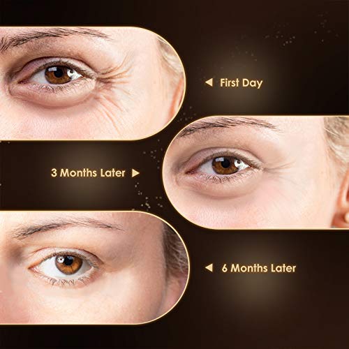 Anti Aging Eye Cream, Retinol Eye Cream Contains Niacinamide and Hyaluronic Acid, Reduces Wrinkles, Puffiness, Crows Feet and Dark Circles, 1 Oz-VivaGrace Women