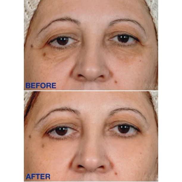 Age-Defying Under-Eye Serum | Best Instant Wrinkle Remover | Advanced Formula Anti Aging Visibly Reduces Under Eye Wrinkles, Bags, Dark Circles, Fine Lines & Crow’s Feet | 100% All-Natural-VivaGrace Women