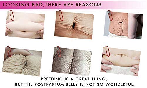 RtopR Mango Stretch Marks and Scar Cream -Stretch Marks and Scar Removal Cream for Pregnancy - Best Body Moisturizer-40g-VivaGrace Women