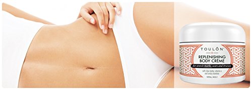 Bruise Cream with Arnica Montana, Shea Butter & Vitamin E: Repair Bruises, Stretch Marks Cream & Scars: 4 oz. For Women and Men-VivaGrace Women