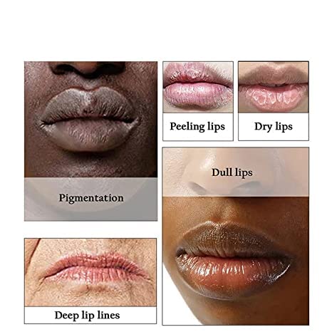 2pcs Lip Lightening for Dark Lips Lip Brightener for Smokers Dark Lip Treatment Lightening Cream for Pink Lips Lip Lightener for Smoker Lips Lip Lightening balm for Men and Women (Orange)-VivaGrace Women
