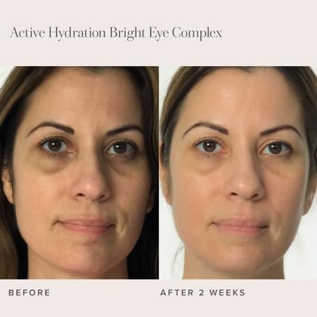 RODAN + FIELDS Active Hydration Bright Eye Complex | 15ml | Moisturizing Under Eye Cream for Dry Skin | Brightening Eye Treatment | Skincare-VivaGrace Women