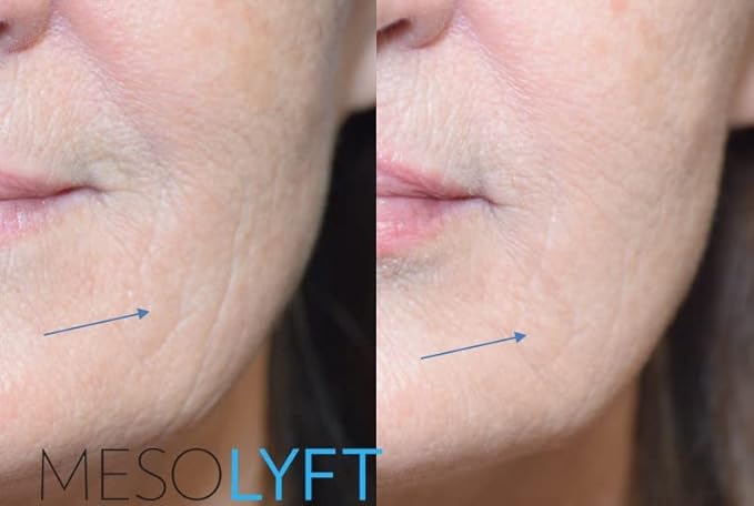 Anti-Aging Serum with Neck & Eyes Combo Skincare Face Serum Reduce Signs of Aging Roller for Face An Effective Treatment for Neck and Eyes-VivaGrace Women