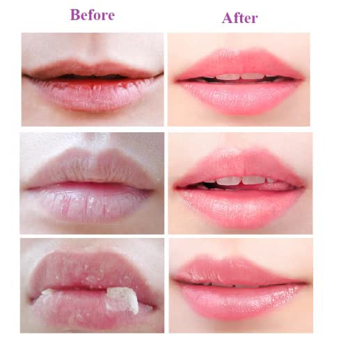 2PCS Lip Balm Honey Pot,Honey & Strawberry Lip Balm, Propolis Moisturizing Honey Lip Mask Lip Balm, Hydrating & Prevention Dry and Cracked Lip Scrubs Exfoliator-VivaGrace Women