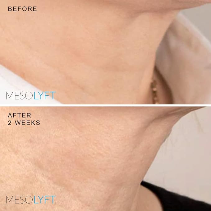 Neck & Eyes Combo Skincare Tool under Eye Serum With Neck Line Remover Neck and Décolletage Beuty Tool & Under Eye Wrinkle Filler Exfoliates the Skin, Visibly Firm & Smooth Necklines-VivaGrace Women