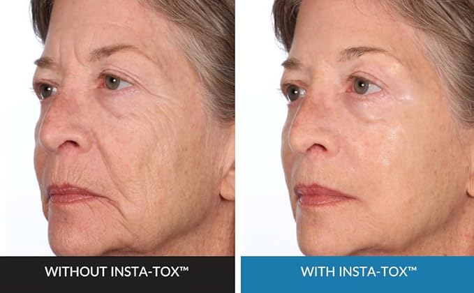 Serious Skincare INSTA-TOX Facial Firming Wrinkle Smoothing Serum and Reverse Lift Firming Eye Cream Set - Filler for Fine Lines, Deep Wrinkles and Pores - Temporary Eye Tightener-VivaGrace Women