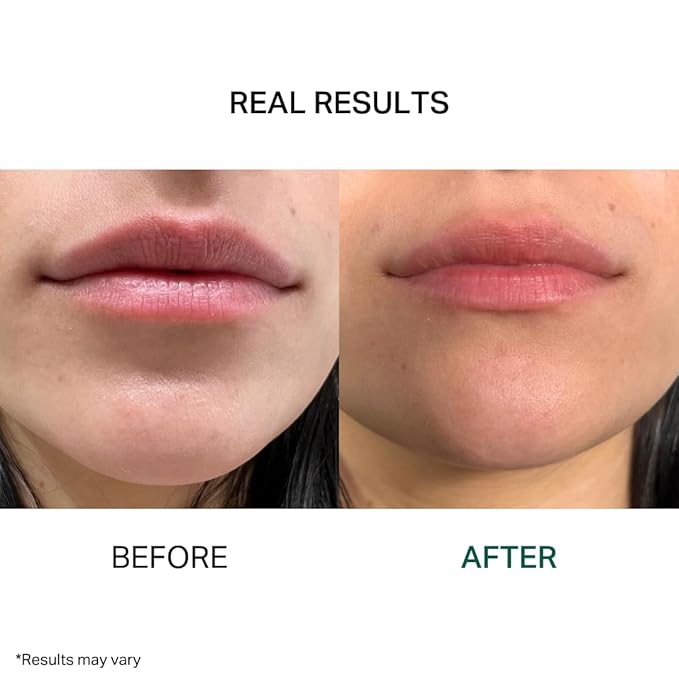 Y’OUR Intensive Lip Balm | Overnight Lip Mask: Lightweight & Comforting with Natural Shea Butter & Rosehip Oil; Extreme Moisturizer for Dry Lips. Paraben & Silicon-Free. Made in USA. 15ml (0.5 oz.)-VivaGrace Women