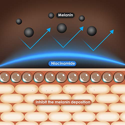 Anti Aging Eye Cream, Retinol Eye Cream Contains Niacinamide and Hyaluronic Acid, Reduces Wrinkles, Puffiness, Crows Feet and Dark Circles, 1 Oz-VivaGrace Women