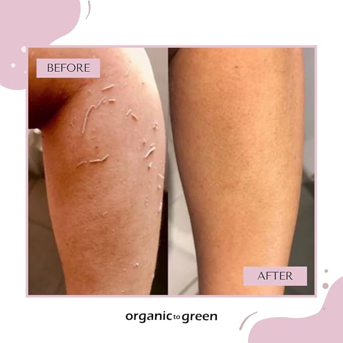 Organic to Green Premium Exfoliating Mitt for Body (2pc) – 100% Vegan Viscose Traditional Body Scrub Washcloth – Body Exfoliator (Pink)-VivaGrace Women