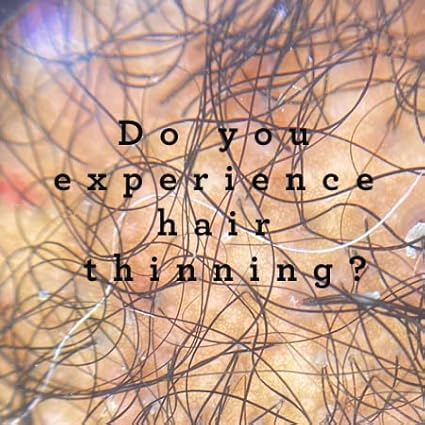 G+H Strengthening Oil | Promotes Thicker, Fuller Hair & Healthy Scalp | With Pumpkin & Rosemary for Healthy Hair | For All Hair Types (2 fl oz)-VivaGrace Women