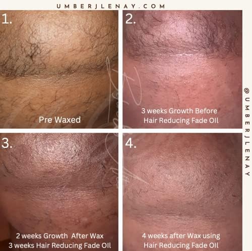 Hair Reducing Fade Oil - Sentive Strength (For sentive skin) Hair Growth Minimizer, Slow Down Facial Hair Growth for Women & Men, Hair Inhibitor Serum, Moisturizing & Soothing, 15ml-VivaGrace Women