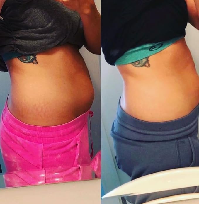 Promise Stretch Mark Prevention Kit, Scars and Dry Skin, Ultra-Hydrating Stretch Mark Cream and Stretch Mark Oil for Pregnant Women, Vegan, Non-Toxic, Set-VivaGrace Women