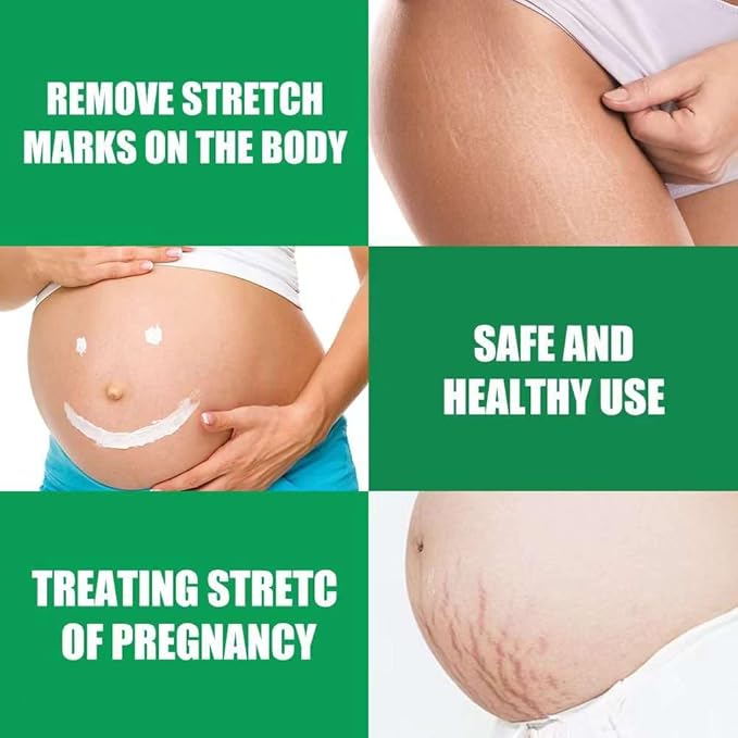 Wrinkle-Relaxing Firming Repair Essence Cream - Removes Maternity Stretch Marks, Prevents Wrinkles & Fine Lines, Nourishes & Rejuvenates Skin with Safe, Natural Formula-VivaGrace Women