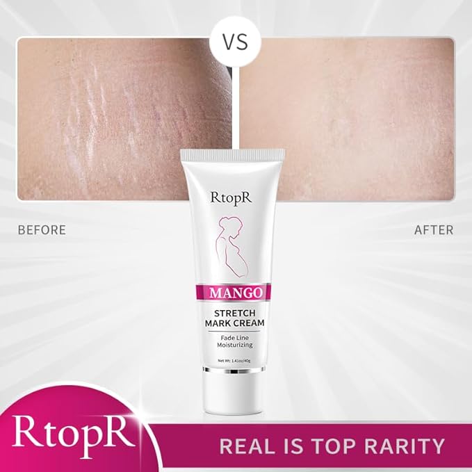 RtopR Mango Stretch Mark Cream for Pregnancy, Stretch Mark Repair Cream, Fade Line, Moisturizing and Non-Greasy, Safe to Use When Pregnant-VivaGrace Women