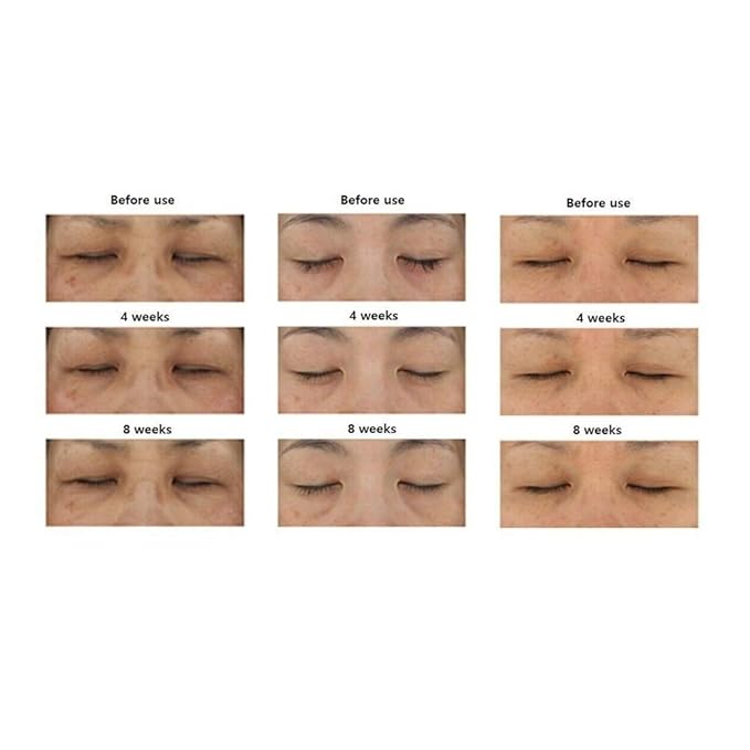 Fermentation Peptine Eye Care Cream 45ml /1.52oz with 8 peptide K-beauty Tube Type…-VivaGrace Women