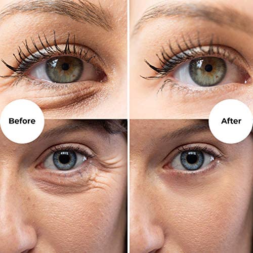 Gle Vitamin C Eye Serum for Dark Circles, Eye Wrinkles and Redness | Dark Circle Under Eye Puffy Eyes Treatment | Caffeine, Vitamin C Hyaluronic Acid | Hydrating & Brightening Scent-Free Travel Size-VivaGrace Women