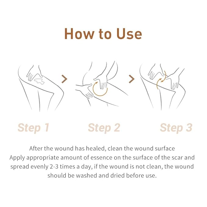 Acne Scar Removal Cream Stretch Marks Face Skin Cream Shrink Pores Gel-Fade Scar Marks Acne Skin Care (Packaging Upgrade) VeniCare-VivaGrace Women