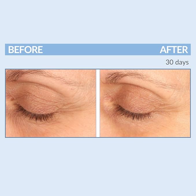 Serious Skincare - Eyetality PM Total Eye Care - Evening Night Eye Cream with Lash Boosting Peptides for Thicker, Longer Lashes - 0.5 oz.-VivaGrace Women