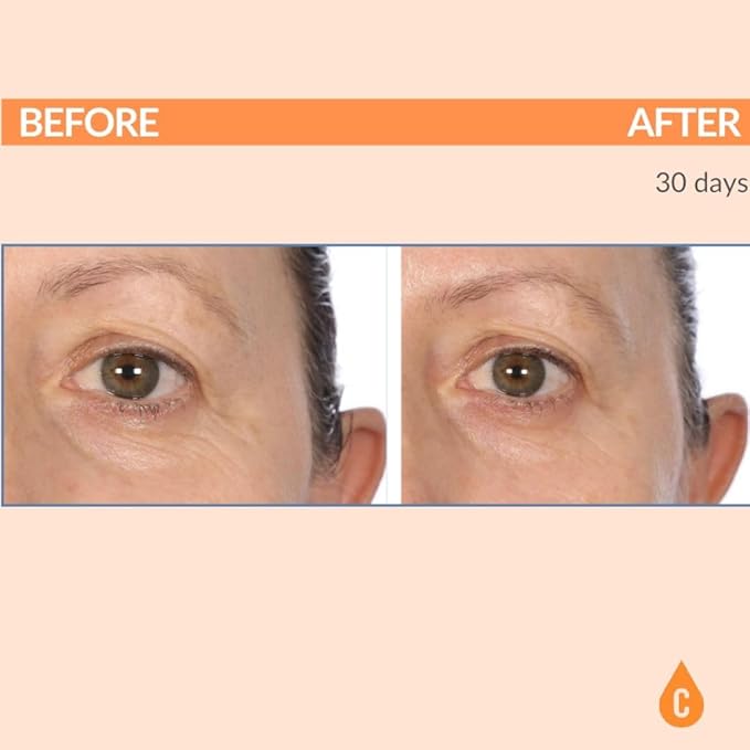 Serious Skincare - C3 Vitamin C Ester Eye Beauty Treatment with Hyaluronic Acid - For Dull & Dry Under Eyes - Soothing C3 Plasma Gel Formula for Fine Lines, Wrinkles, Discoloration - 0.5 oz.-VivaGrace Women